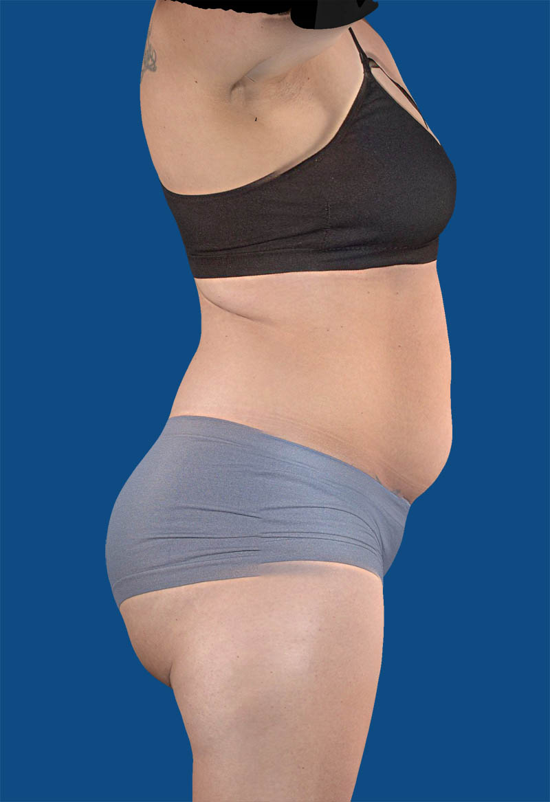 After image