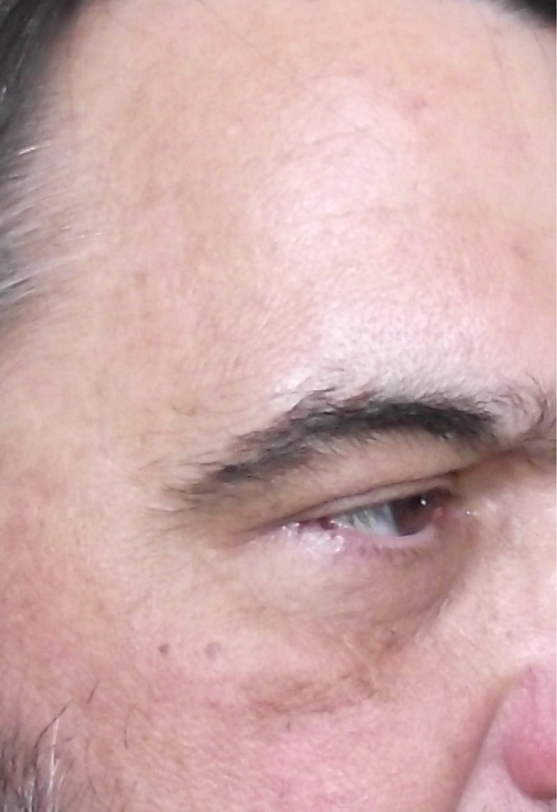 After image