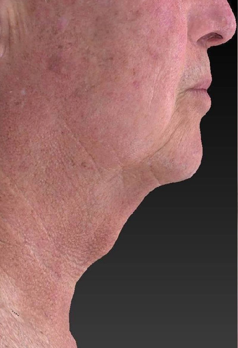After image