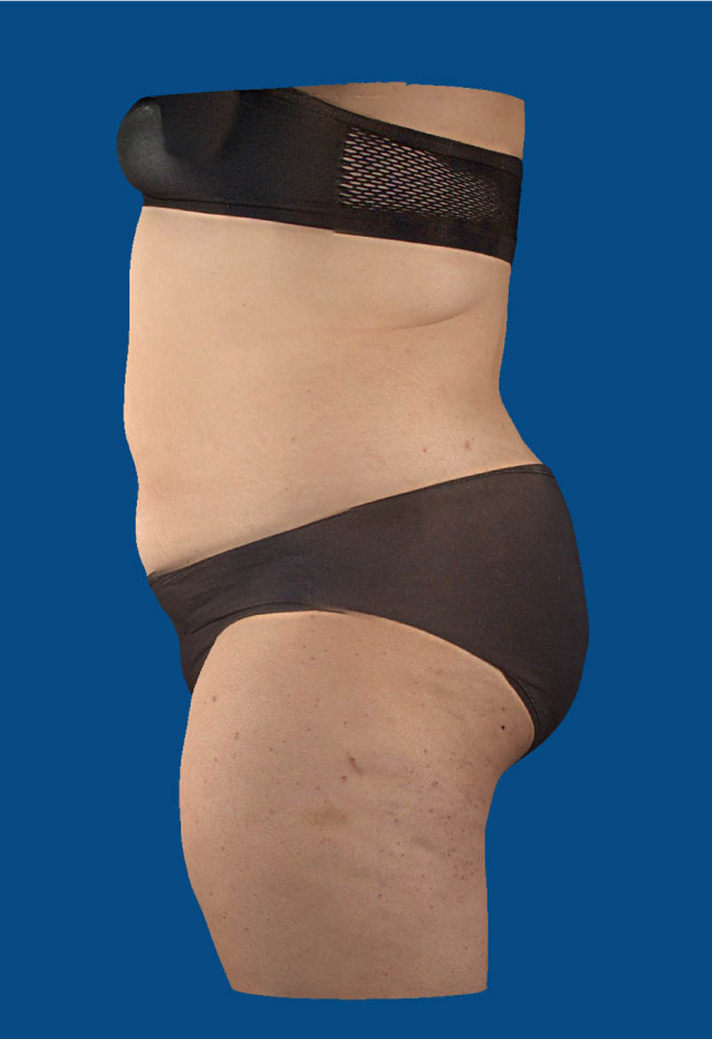After image