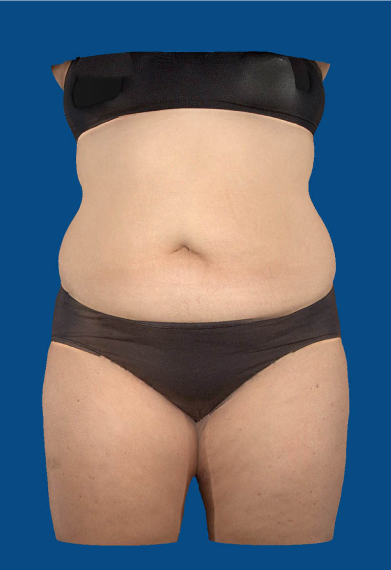 After image