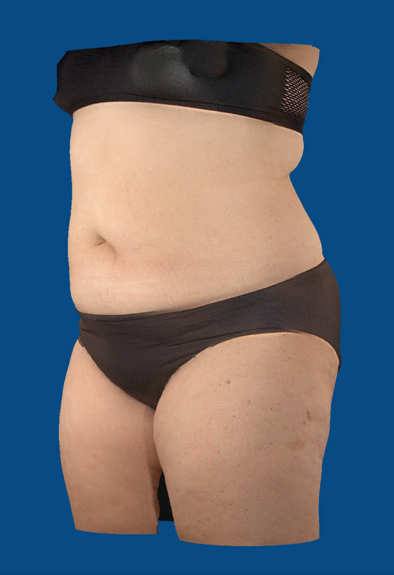 After image