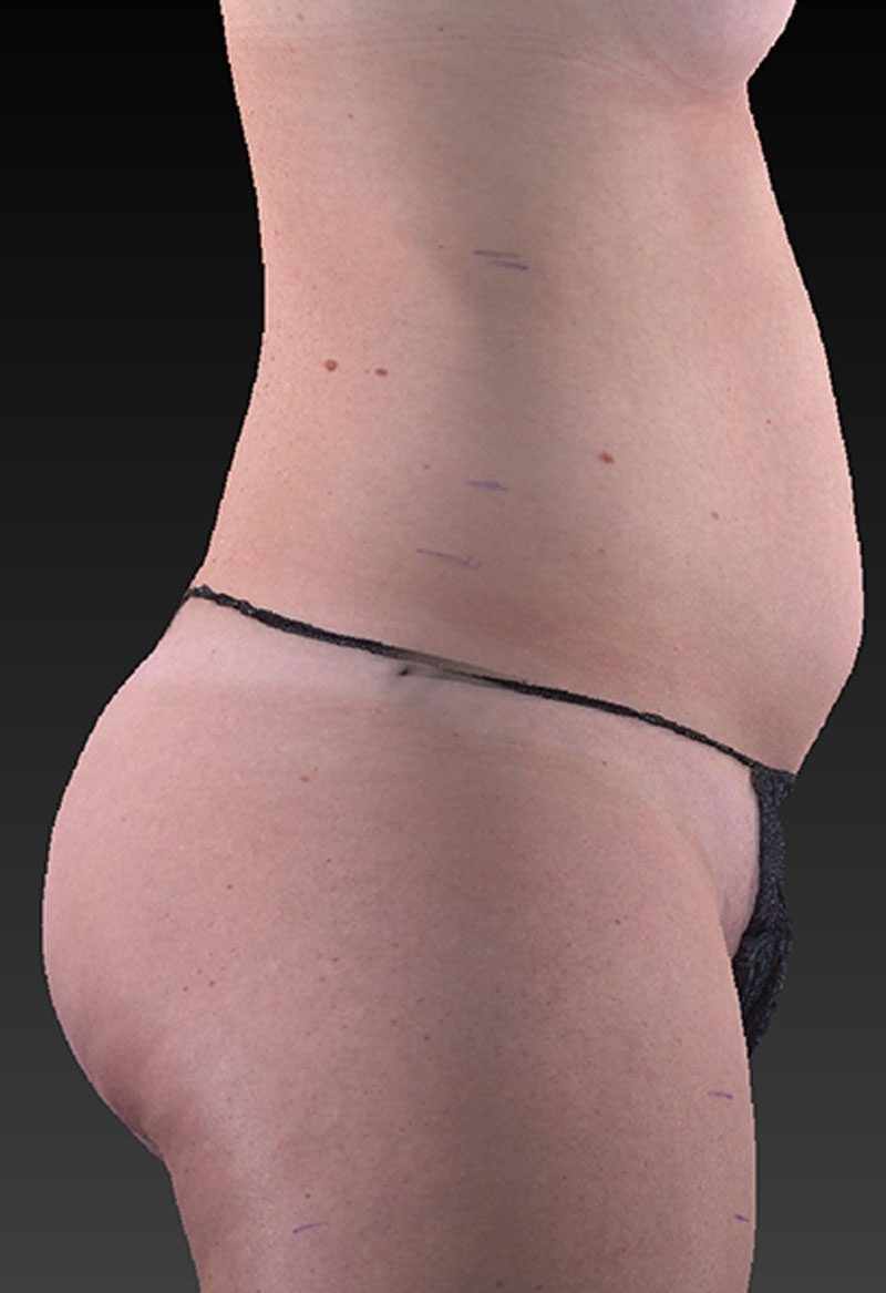 Before image