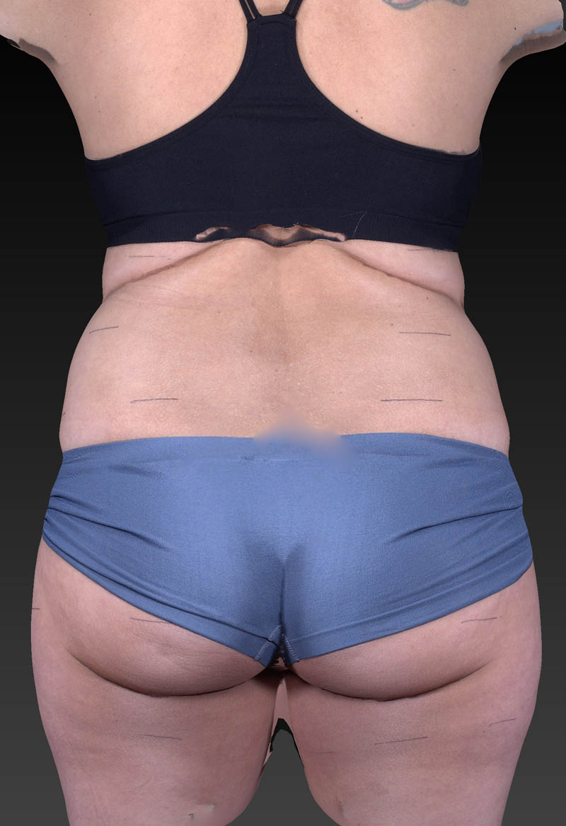 Before image