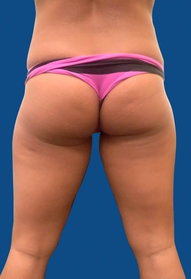 Before image