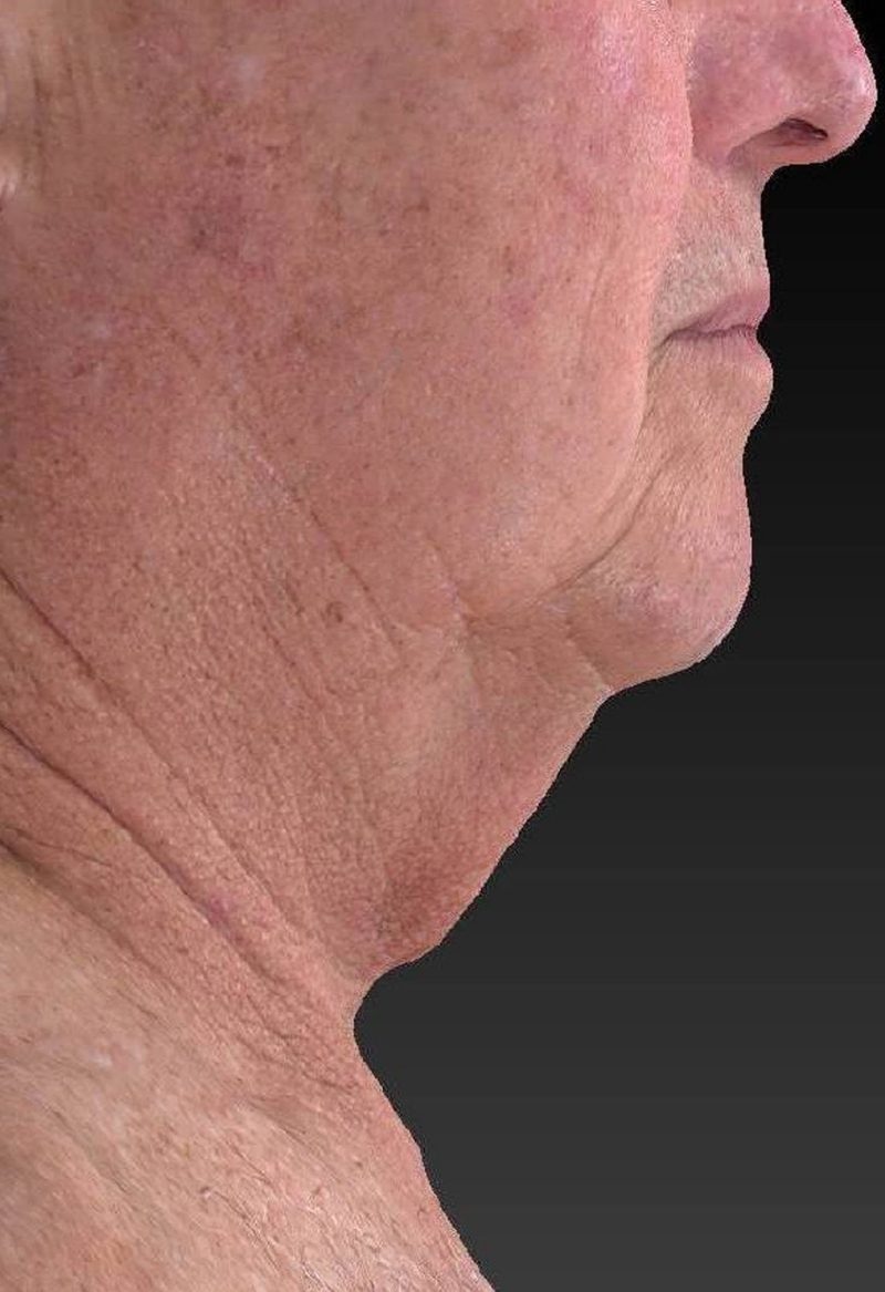 Before image