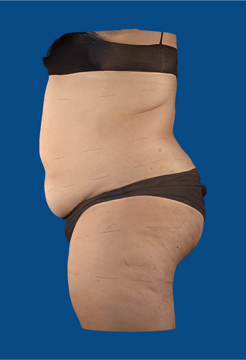 Before image