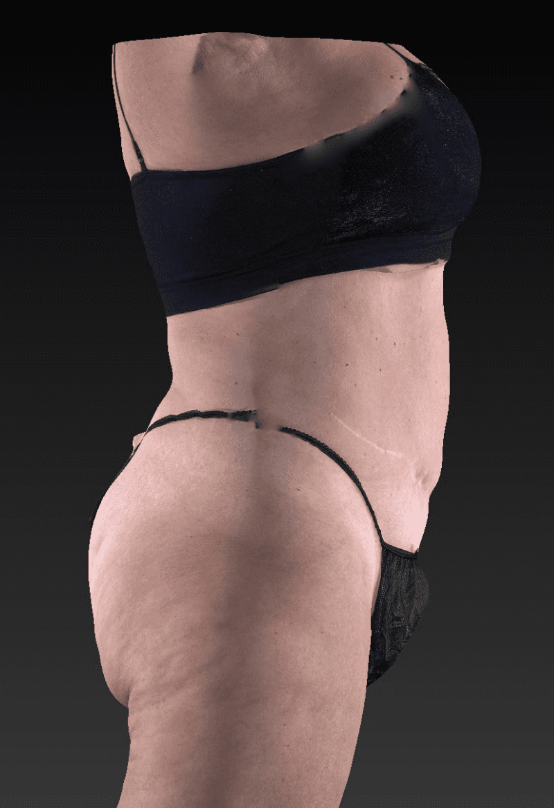 After image