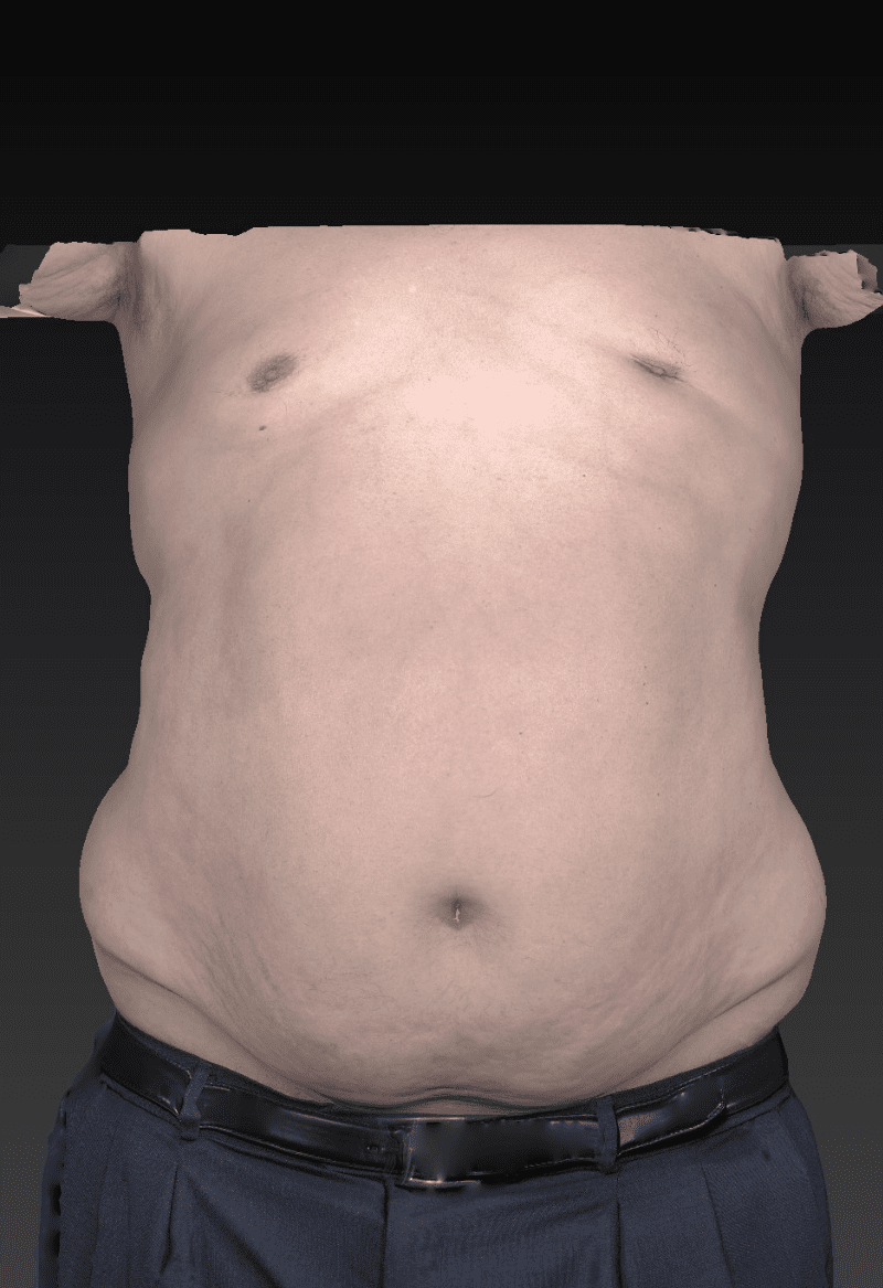 After image
