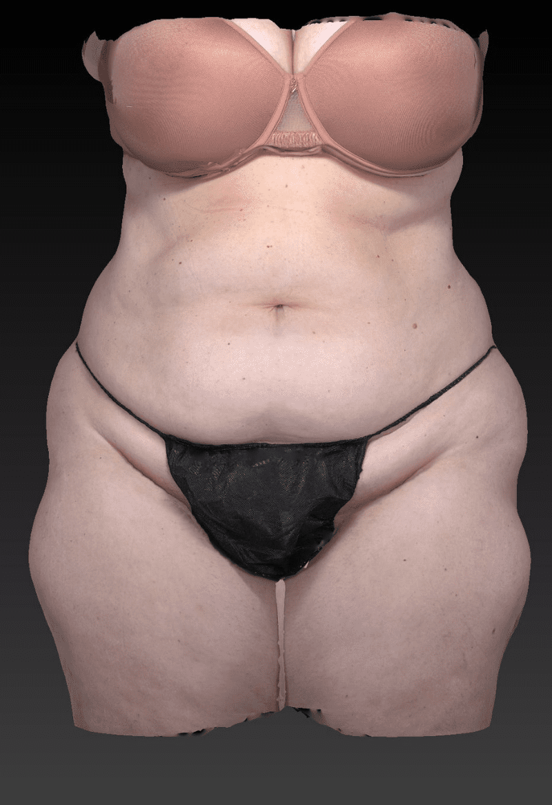 After image