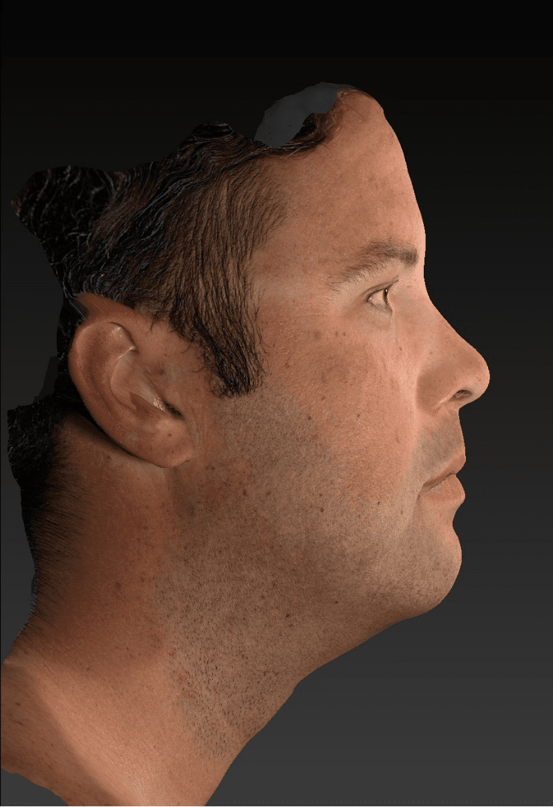 After image