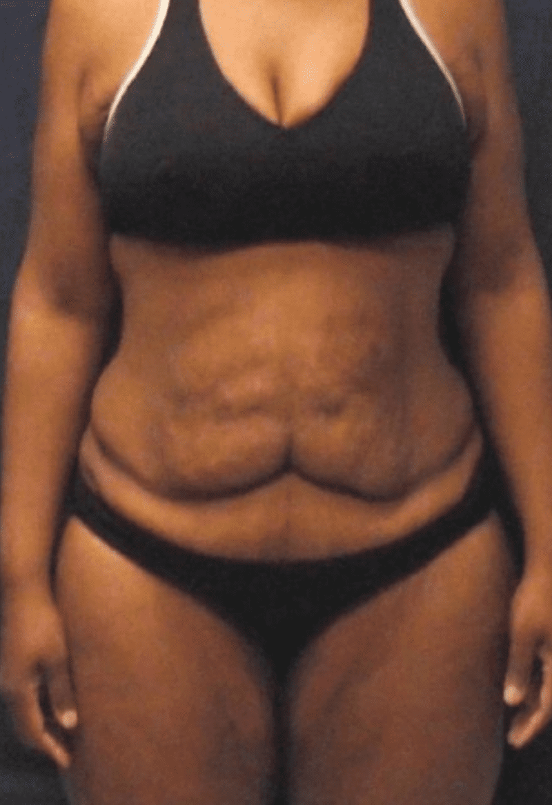 After image