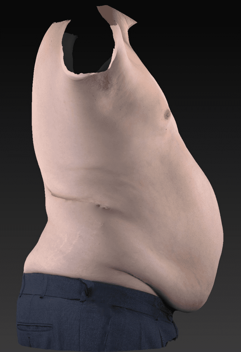 Before image