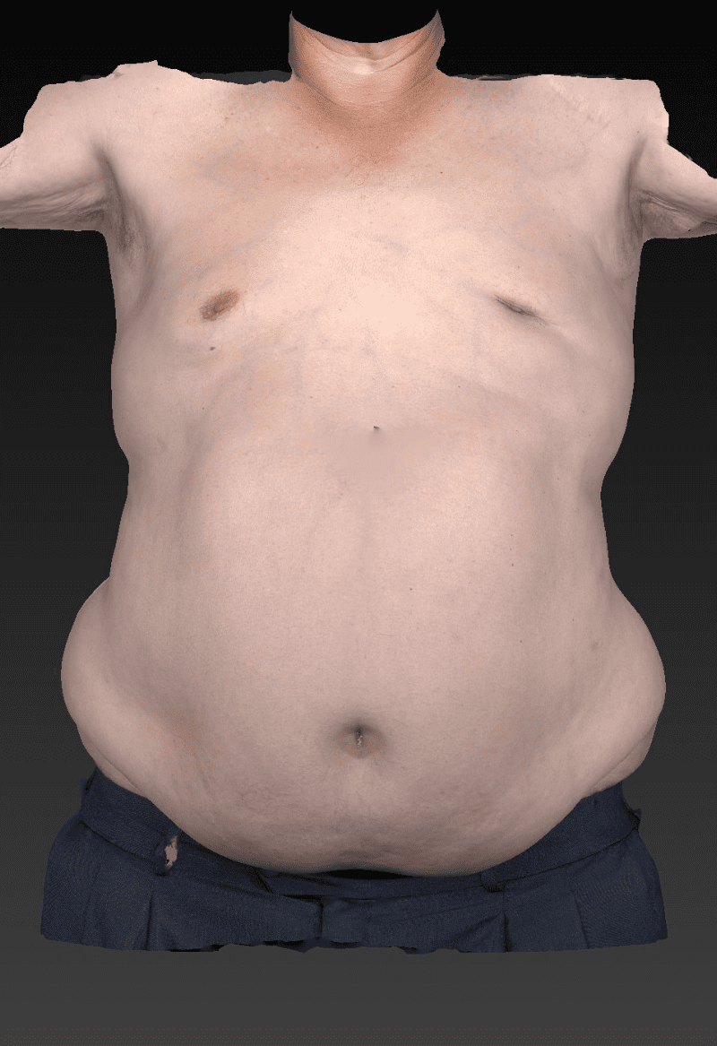 Before image