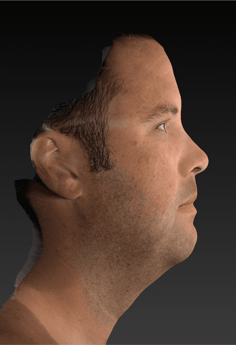 Before image
